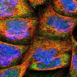 Immunocytochemistry/Immunofluorescence: TROVE2 Antibody [NBP1-86998] Staining of human cell line A-431 shows positivity in cytoplasm.