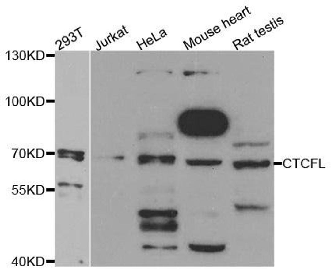 Western blot analysis of extracts of various cell lines using CTCFL antibody