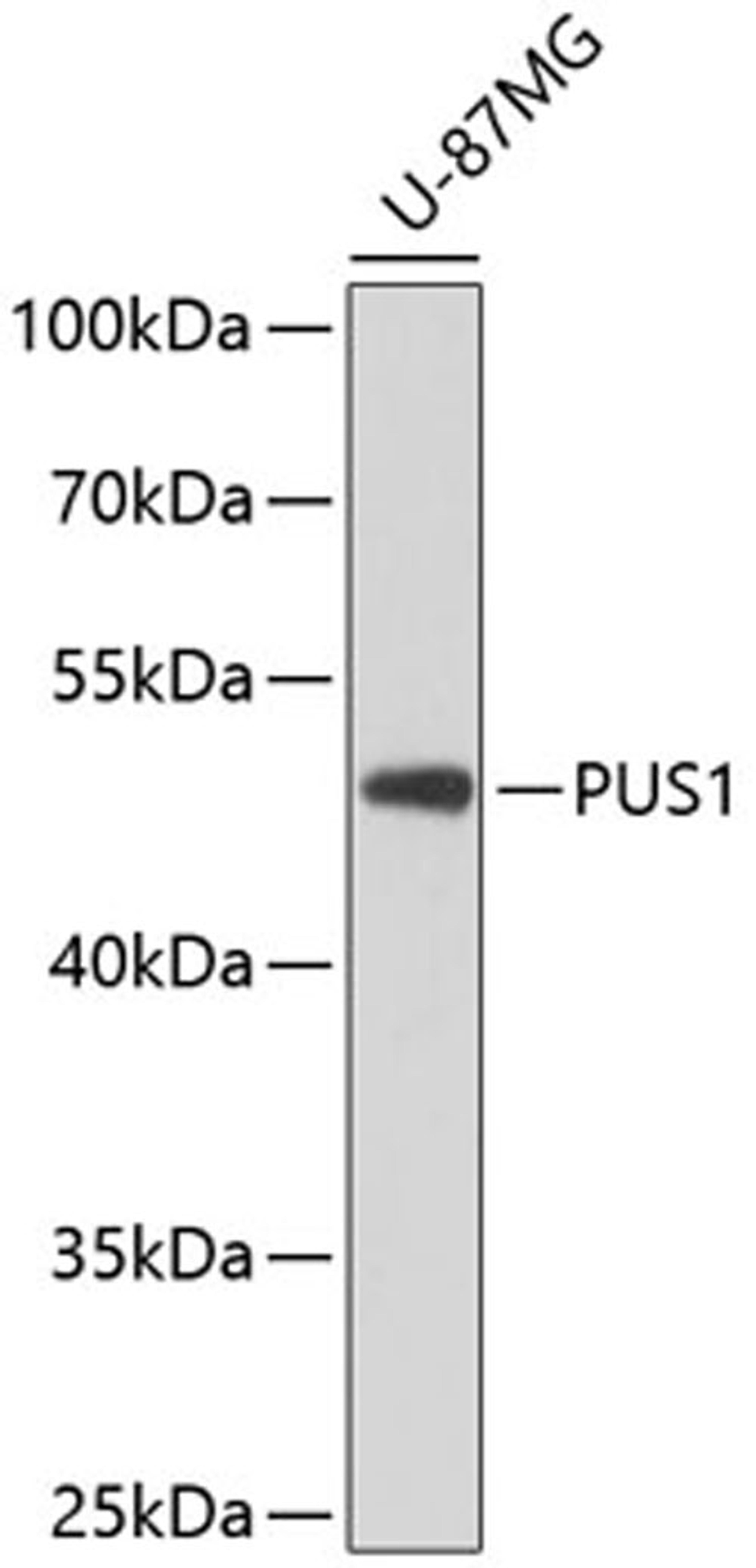 Western blot - PUS1 antibody (A8720)