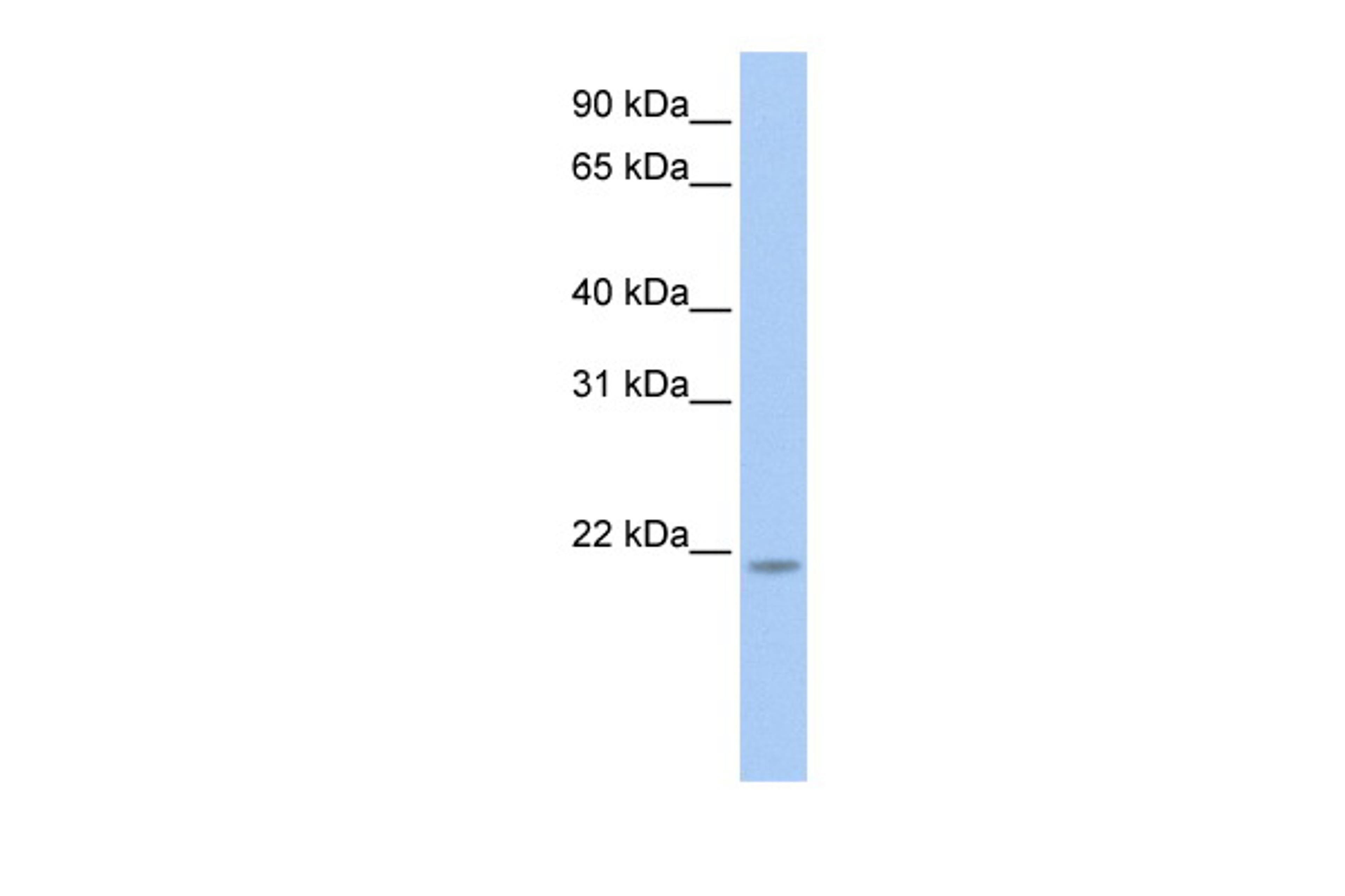 Antibody used in WB on Human HeLa at 0.2-1 ug/ml.