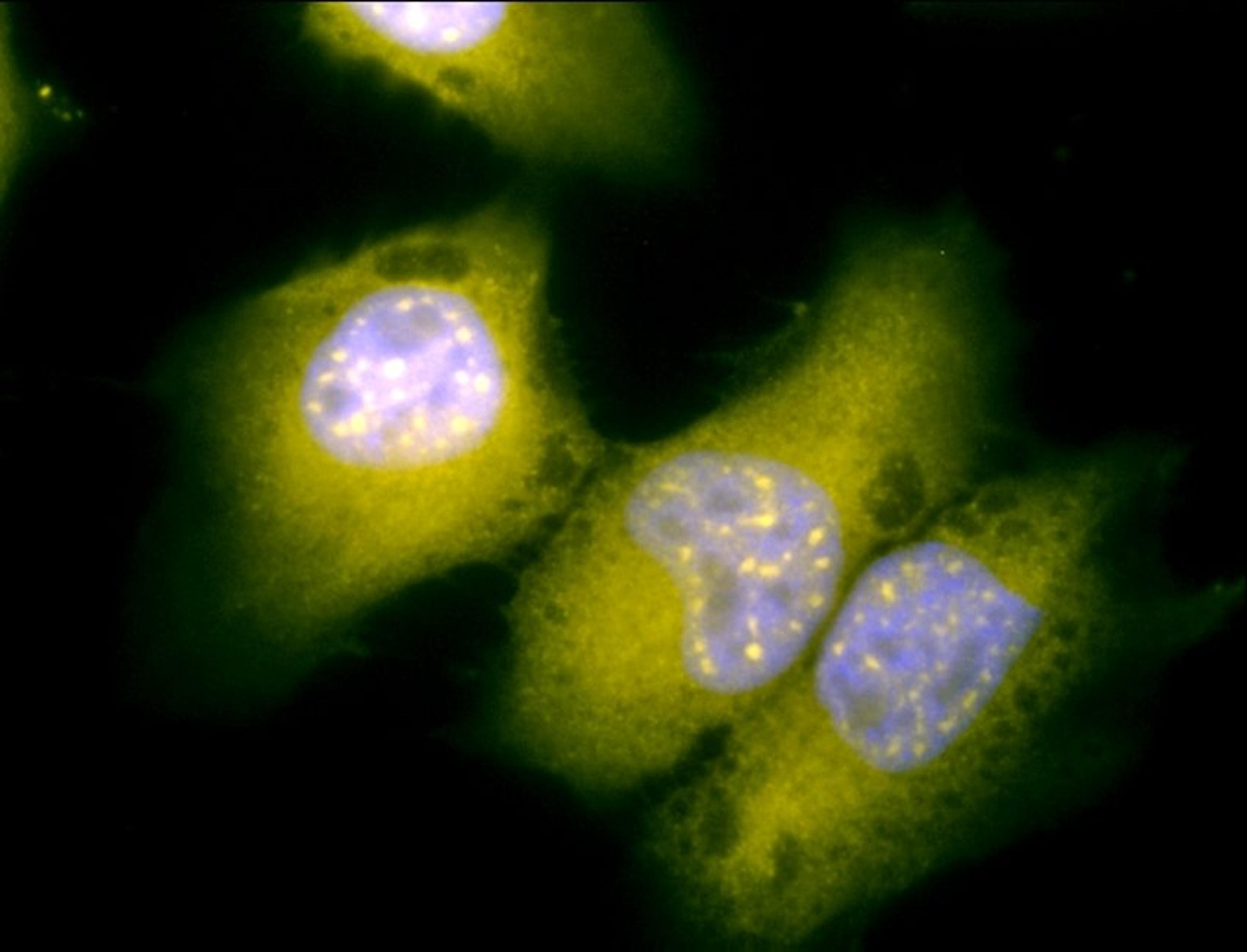 Immunofluorescence analysis of heat shocked hela cells using GRP78 antibody