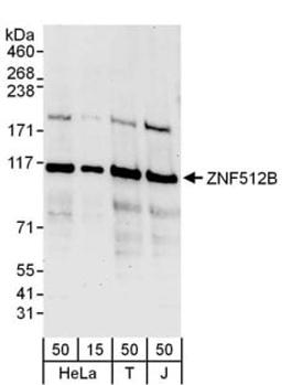 Detection of human ZNF512B by western blot.