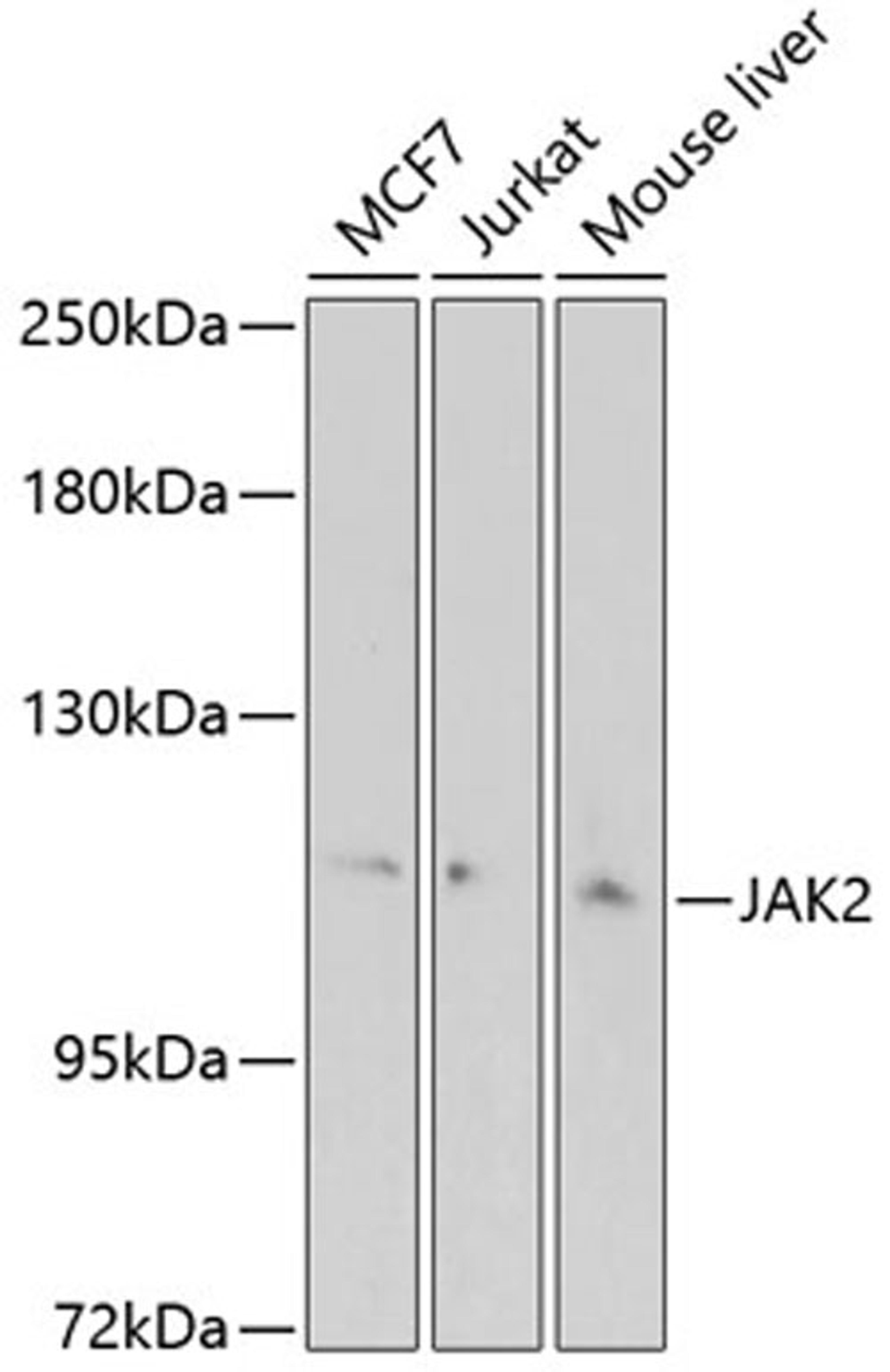 Western blot - JAK2 antibody (A7694)