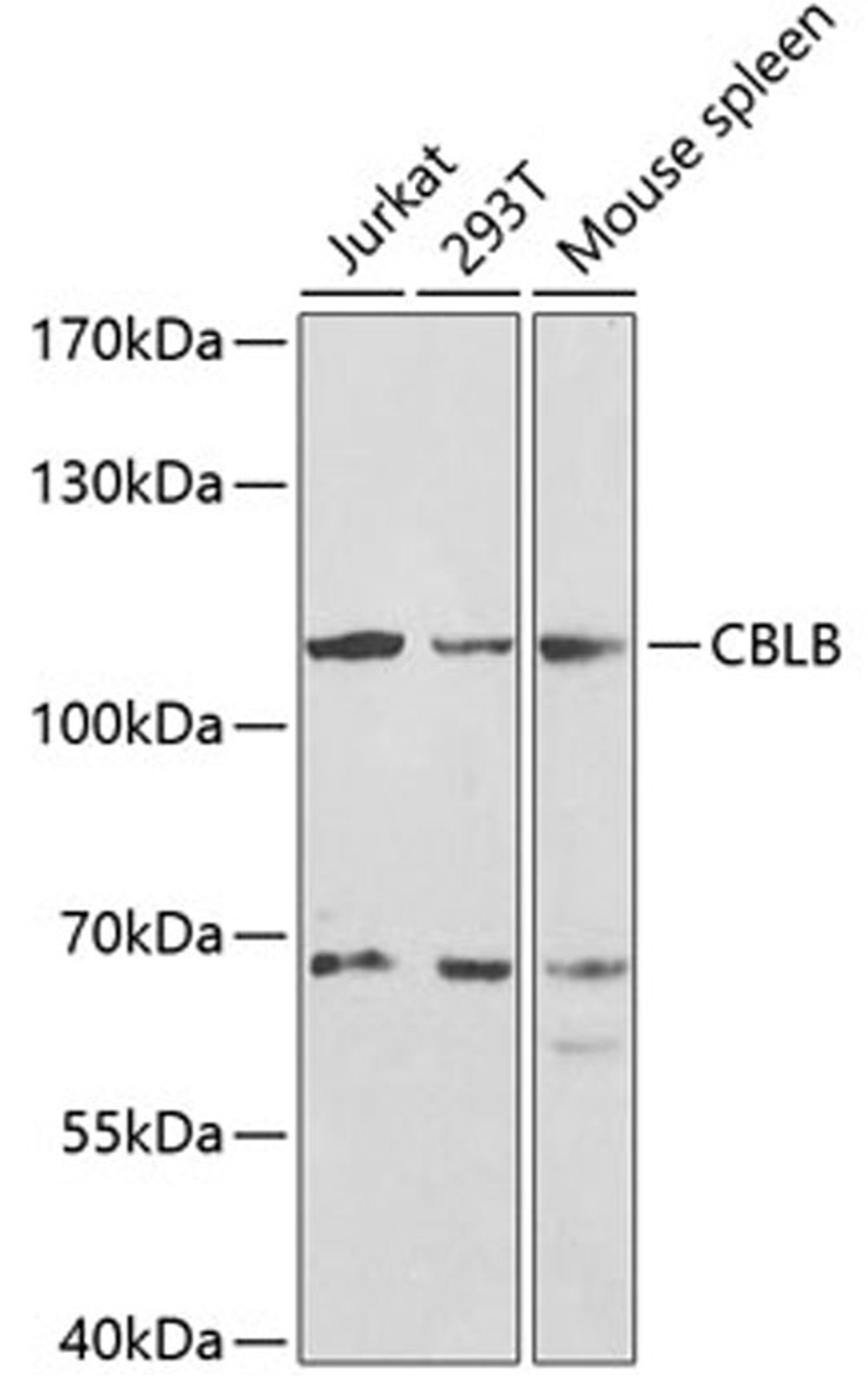 Western blot - CBLB antibody (A2014)