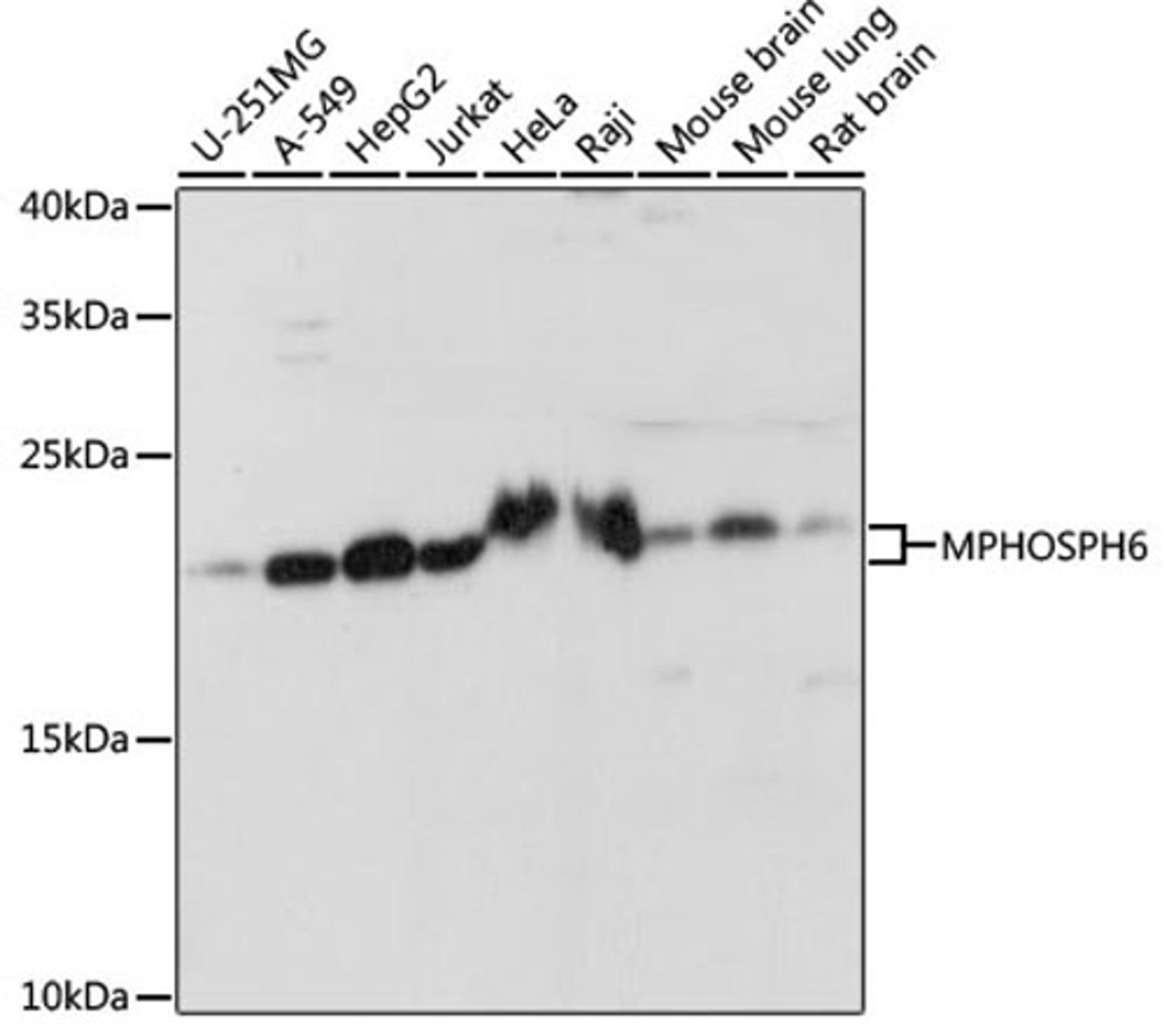 Western blot - MPHOSPH6 antibody (A15775)