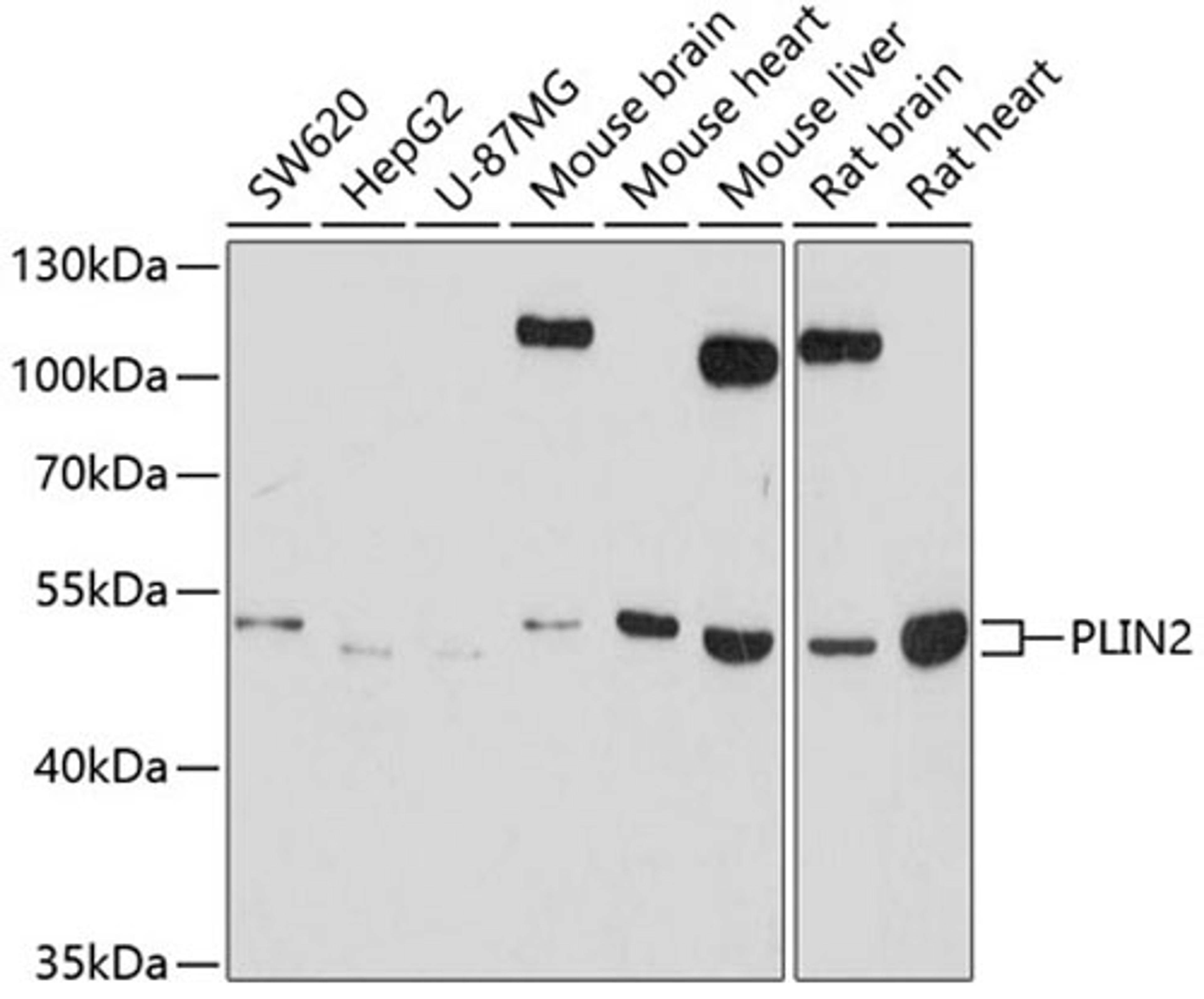 Western blot - PLIN2 antibody (A6276)