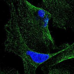 Immunocytochemistry/Immunofluorescence: CABP5 Antibody [NBP1-86691] - Staining of human cell line U-2 OS shows positivity in cytoplasm & cytoskeleton (microtubules).