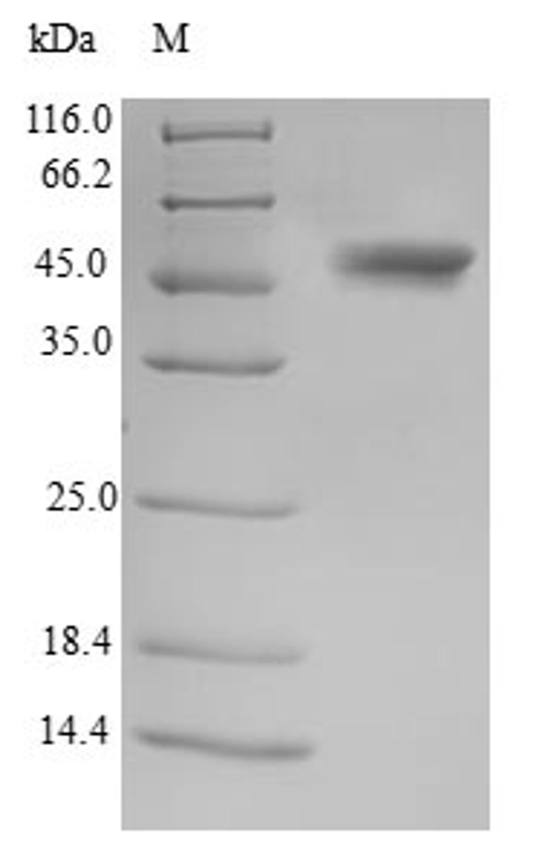 (Tris-Glycine gel) Discontinuous SDS-PAGE (reduced) with 5% enrichment gel and 15% separation gel.