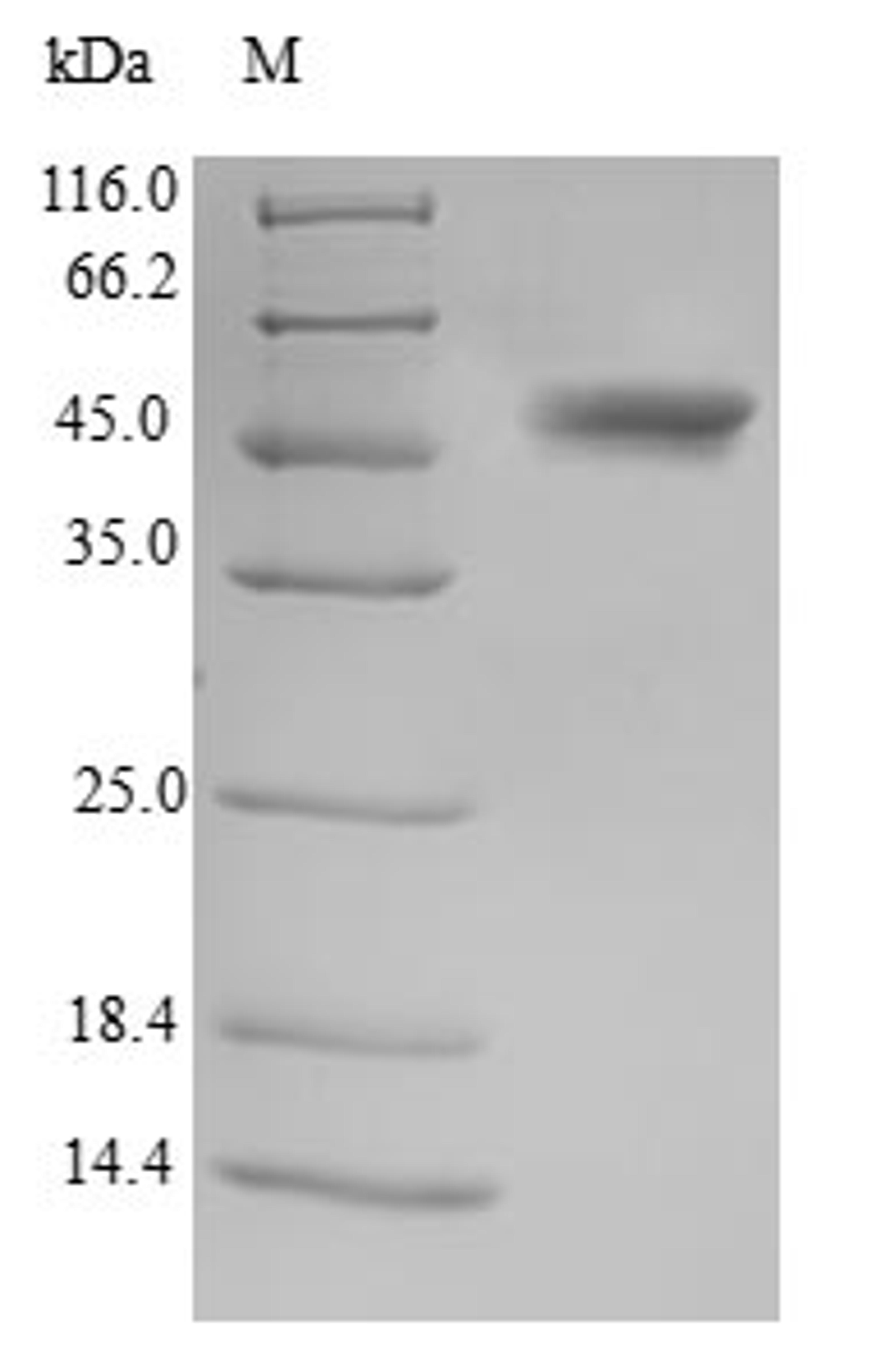 (Tris-Glycine gel) Discontinuous SDS-PAGE (reduced) with 5% enrichment gel and 15% separation gel.