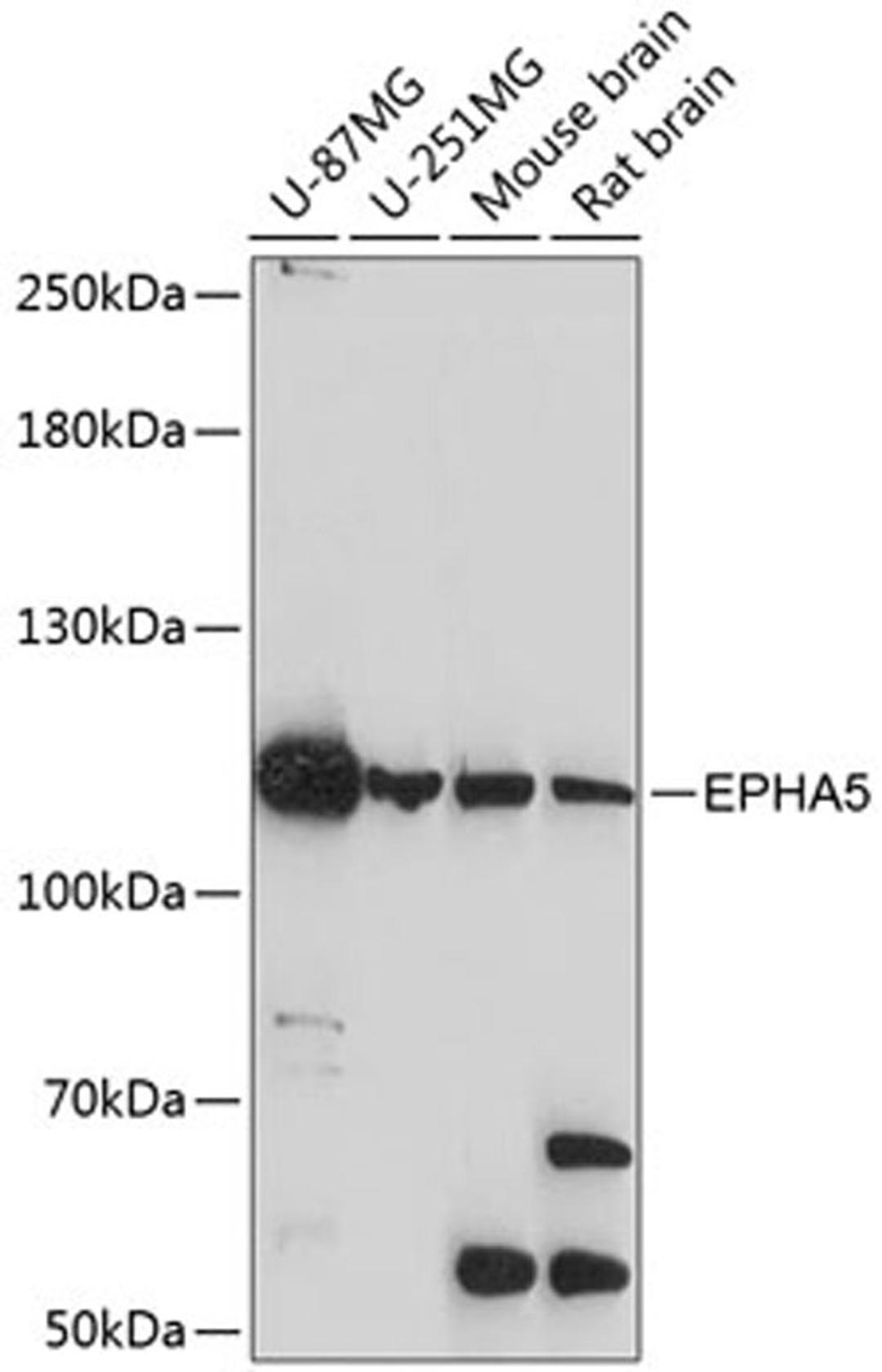 Western blot - EPHA5 antibody (A14238)