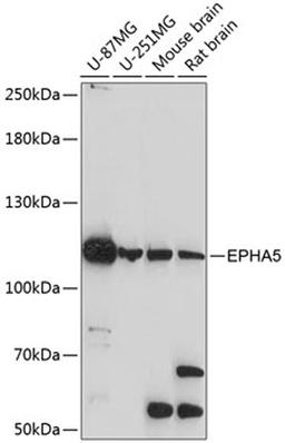 Western blot - EPHA5 antibody (A14238)