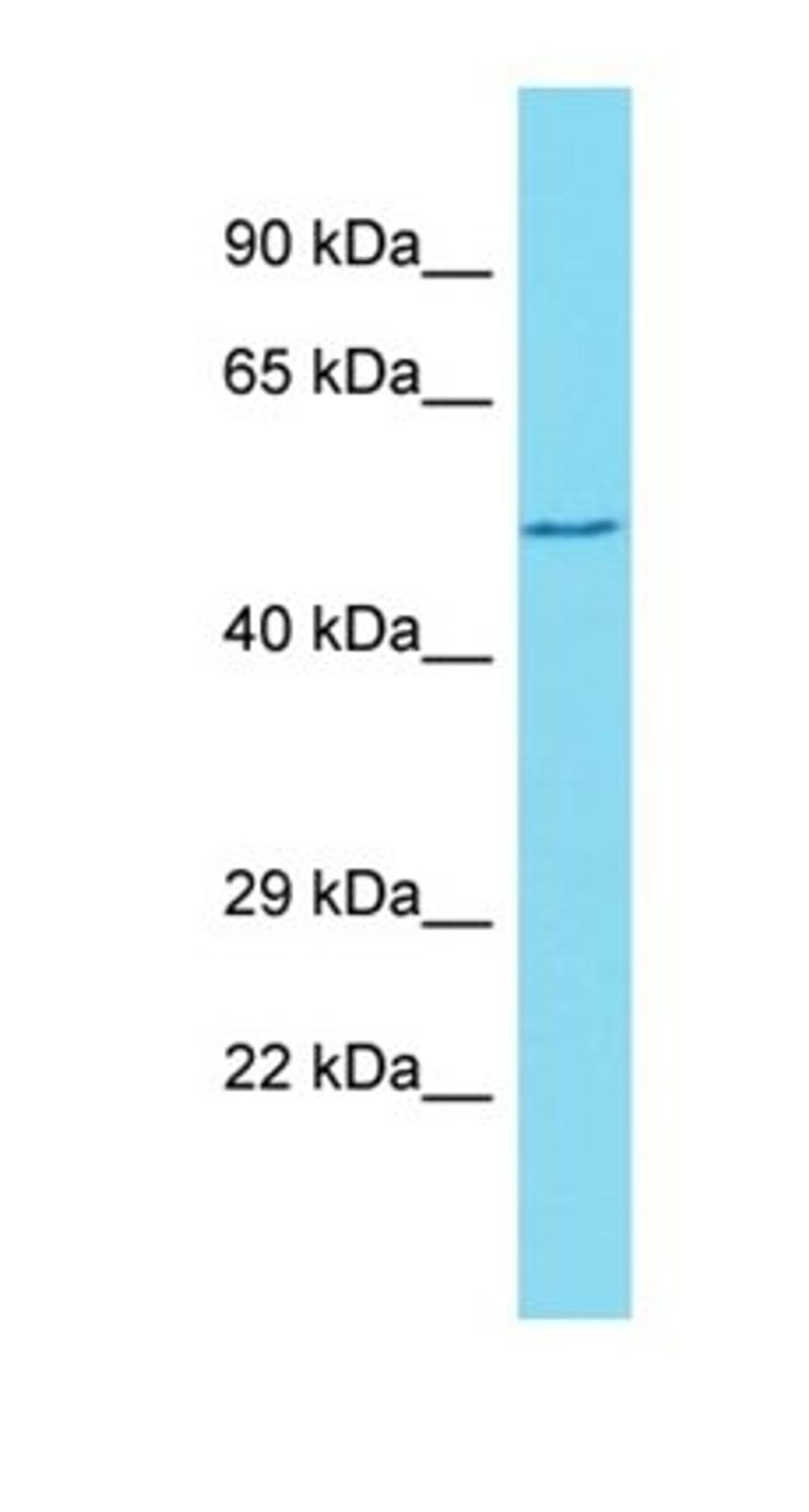 Western blot analysis of human Jurkat tissue using GXYLT1 antibody