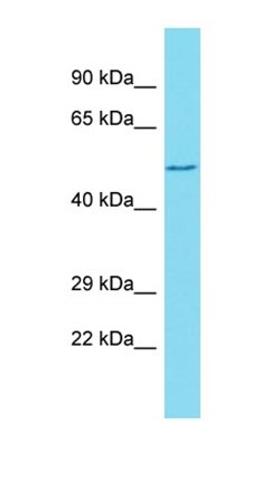 Western blot analysis of human Jurkat tissue using GXYLT1 antibody