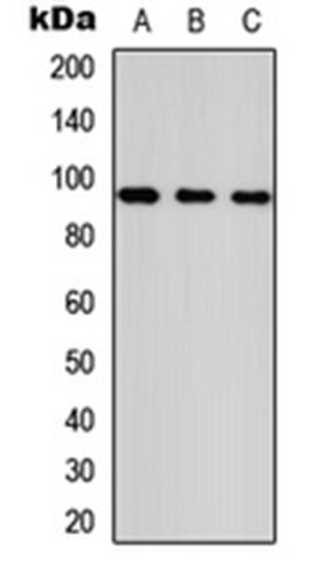 Western blot analysis of HeLa (Lane 1), NS-1 (Lane 2), PC12 (Lane 3) whole cell lysates using ANKRD20A1 antibody