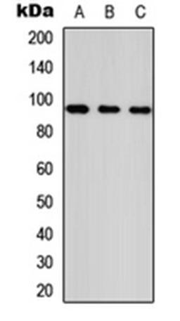 Western blot analysis of HeLa (Lane 1), NS-1 (Lane 2), PC12 (Lane 3) whole cell lysates using ANKRD20A1 antibody