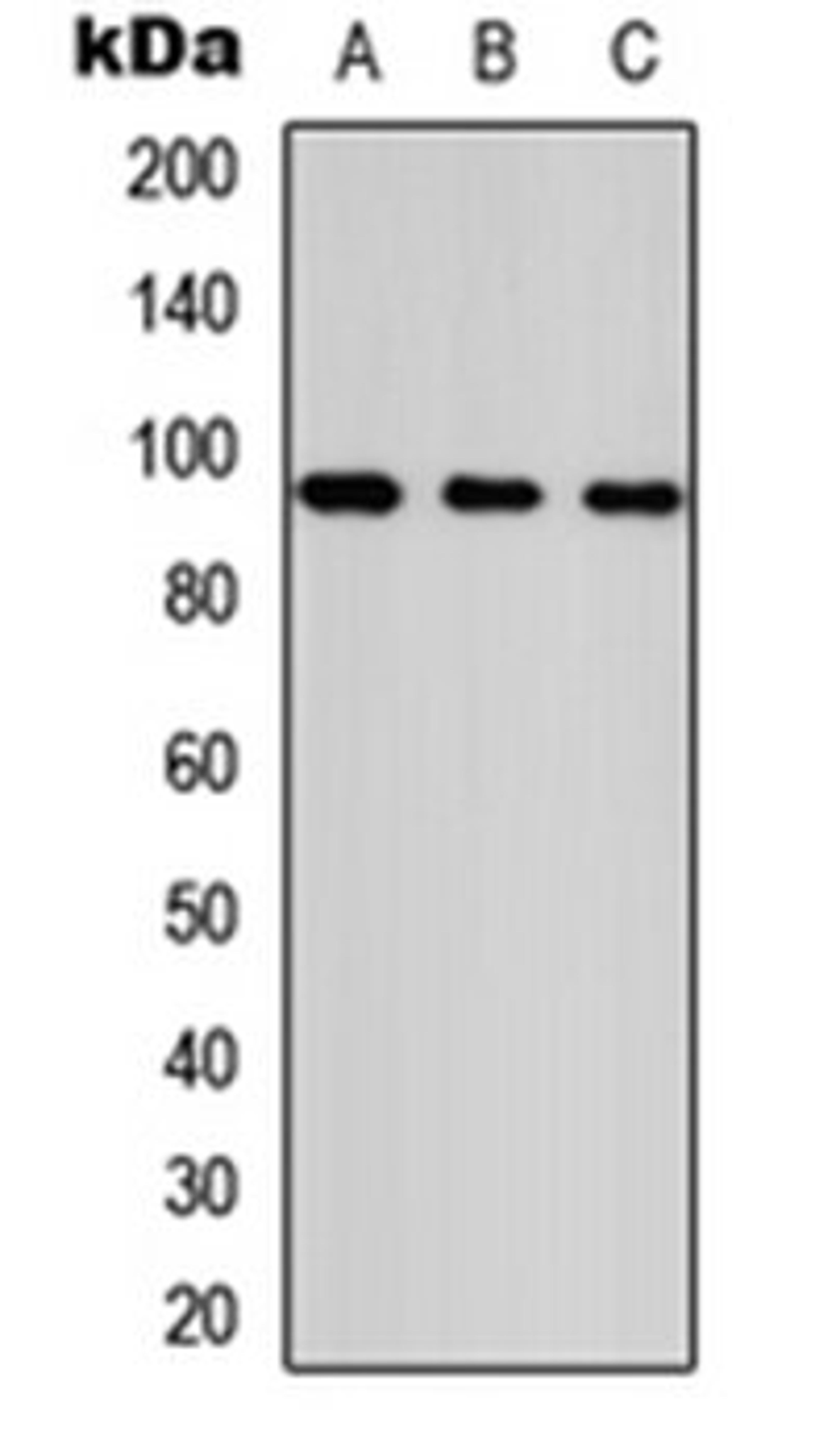 Western blot analysis of HeLa (Lane 1), NS-1 (Lane 2), PC12 (Lane 3) whole cell lysates using ANKRD20A1 antibody