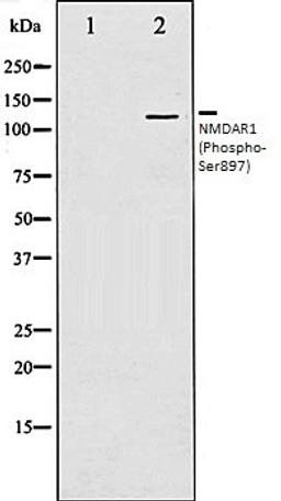 Western blot analysis of LOVO whole cell lysates using NMDAR1 (Phospho-Ser897) antibody, The lane on the left is treated with the antigen-specific peptide.