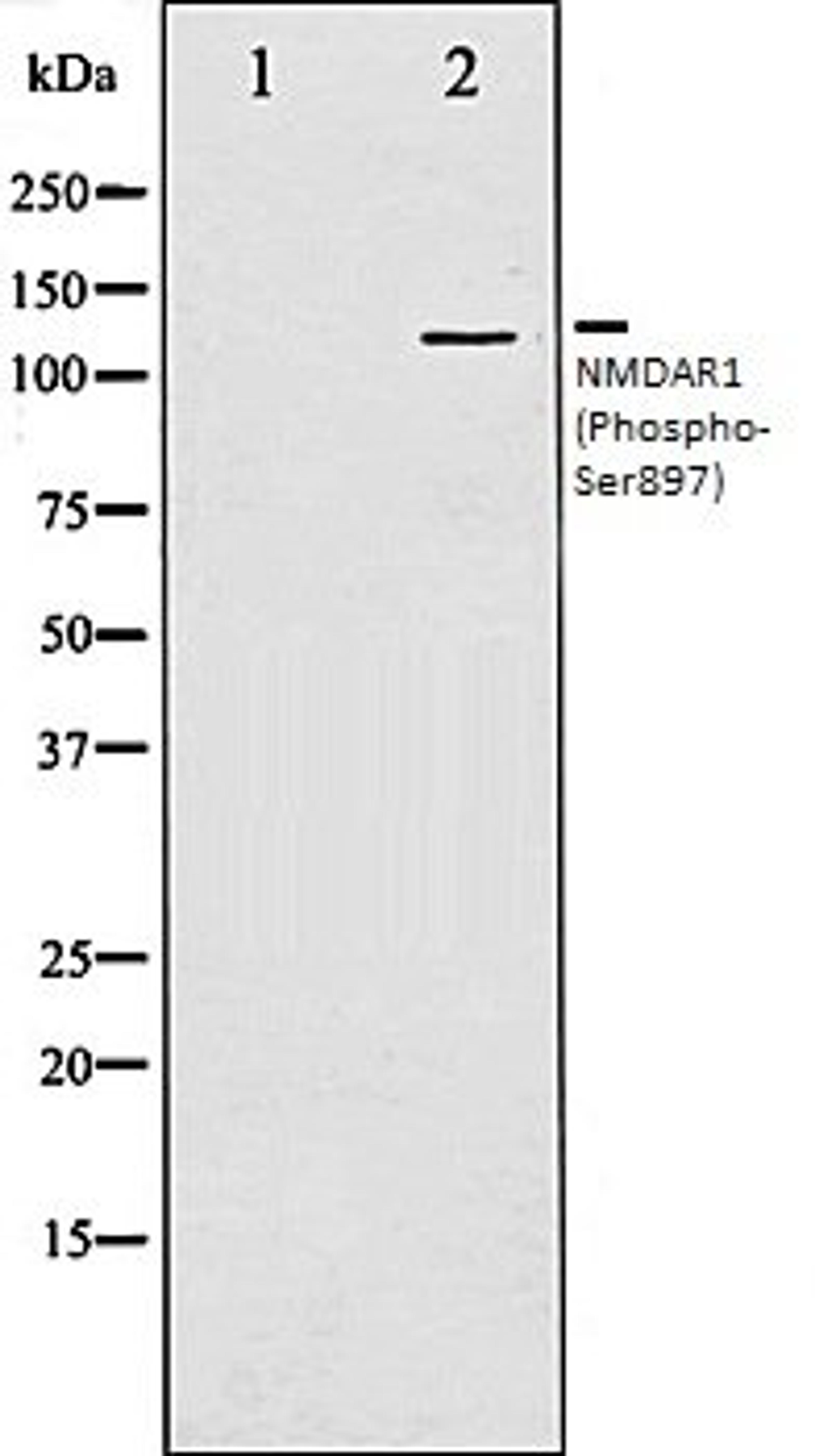 Western blot analysis of LOVO whole cell lysates using NMDAR1 (Phospho-Ser897) antibody, The lane on the left is treated with the antigen-specific peptide.