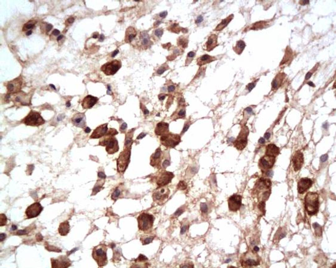 Immunohistochemical analysis of paraffin embedded rat subcutaneous tissue using GLUT2 antibody