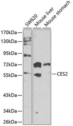 Western blot - CES2 antibody (A13640)