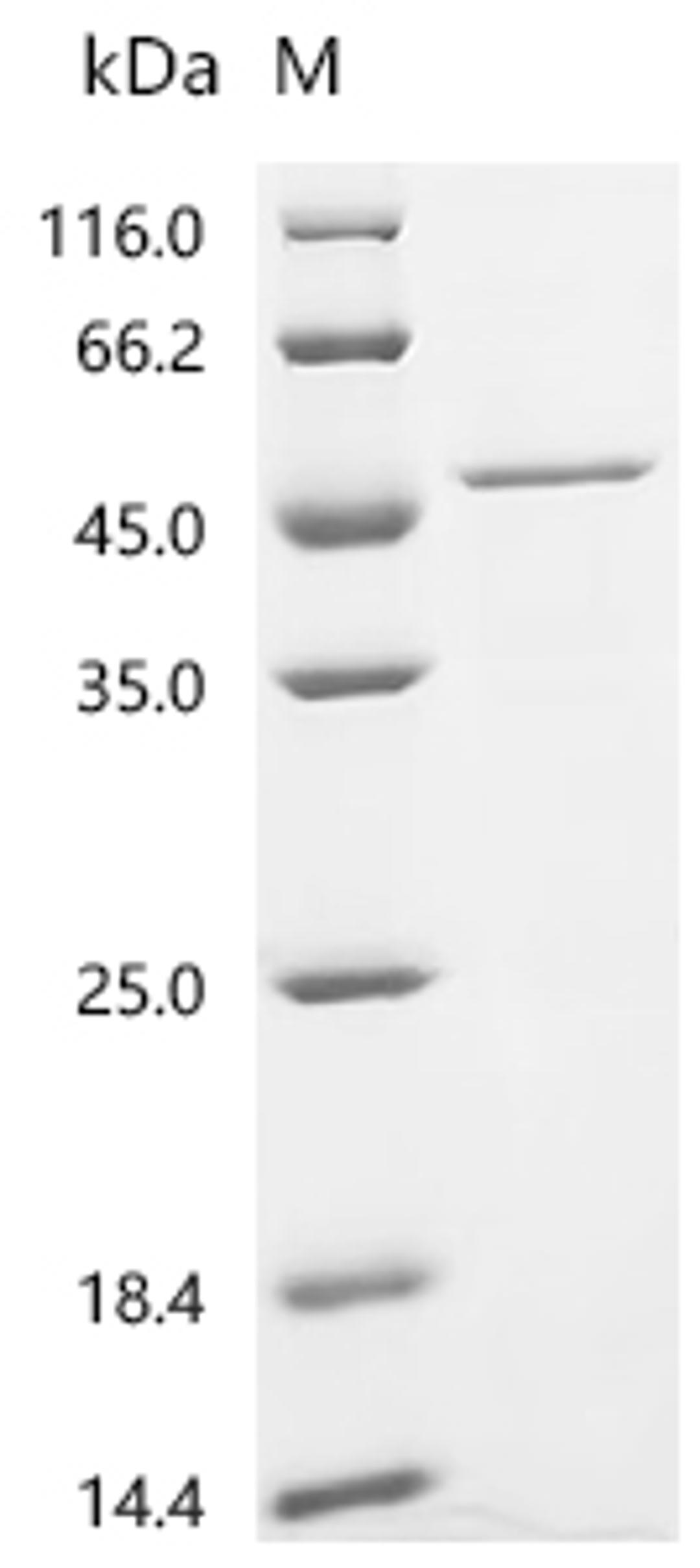 (Tris-Glycine gel) Discontinuous SDS-PAGE (reduced) with 5% enrichment gel and 15% separation gel.