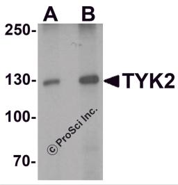 Western blot analysis of TYK2 in human small intestine tissue lysate with TYK2 antibody at (A) 1 and (B) 2 &#956;g/mL