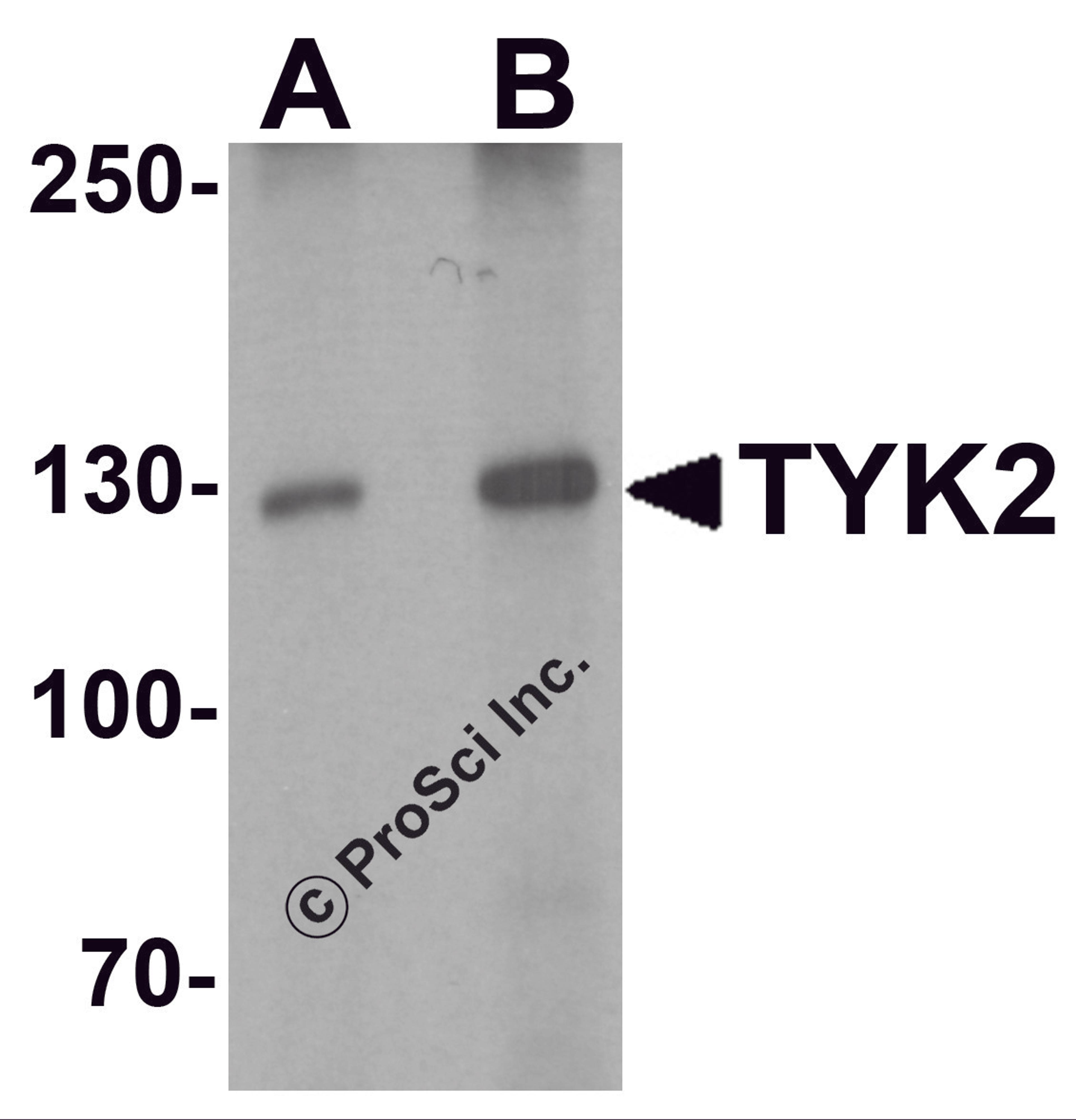 Western blot analysis of TYK2 in human small intestine tissue lysate with TYK2 antibody at (A) 1 and (B) 2 &#956;g/mL