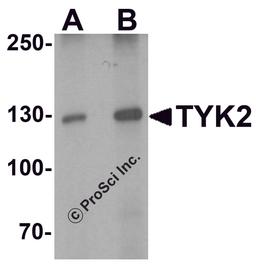 Western blot analysis of TYK2 in human small intestine tissue lysate with TYK2 antibody at (A) 1 and (B) 2 μg/mL