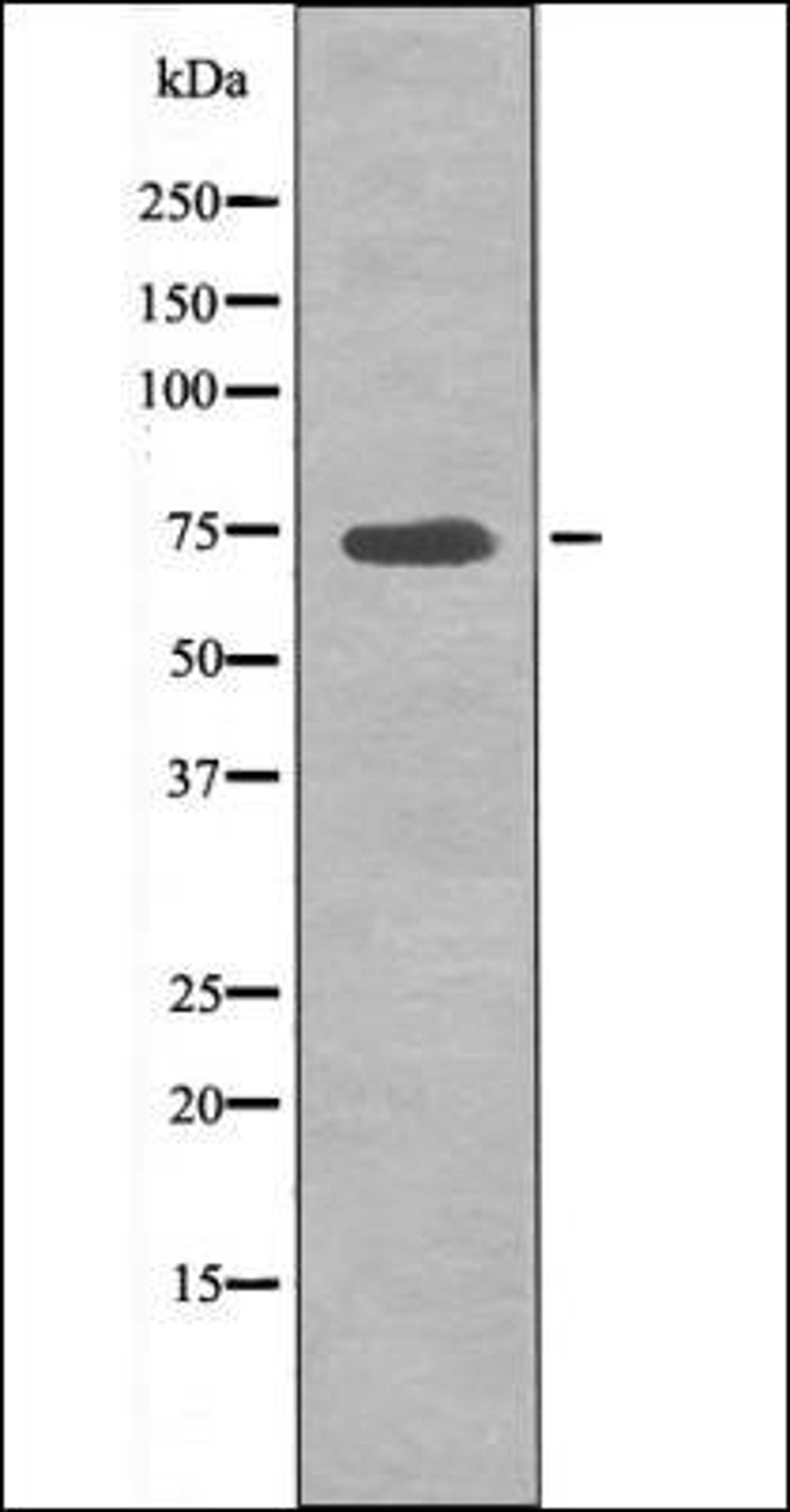 Western blot analysis of HeLa whole cell lysates using p70 S6 Kinase -Phospho-Ser427- antibody