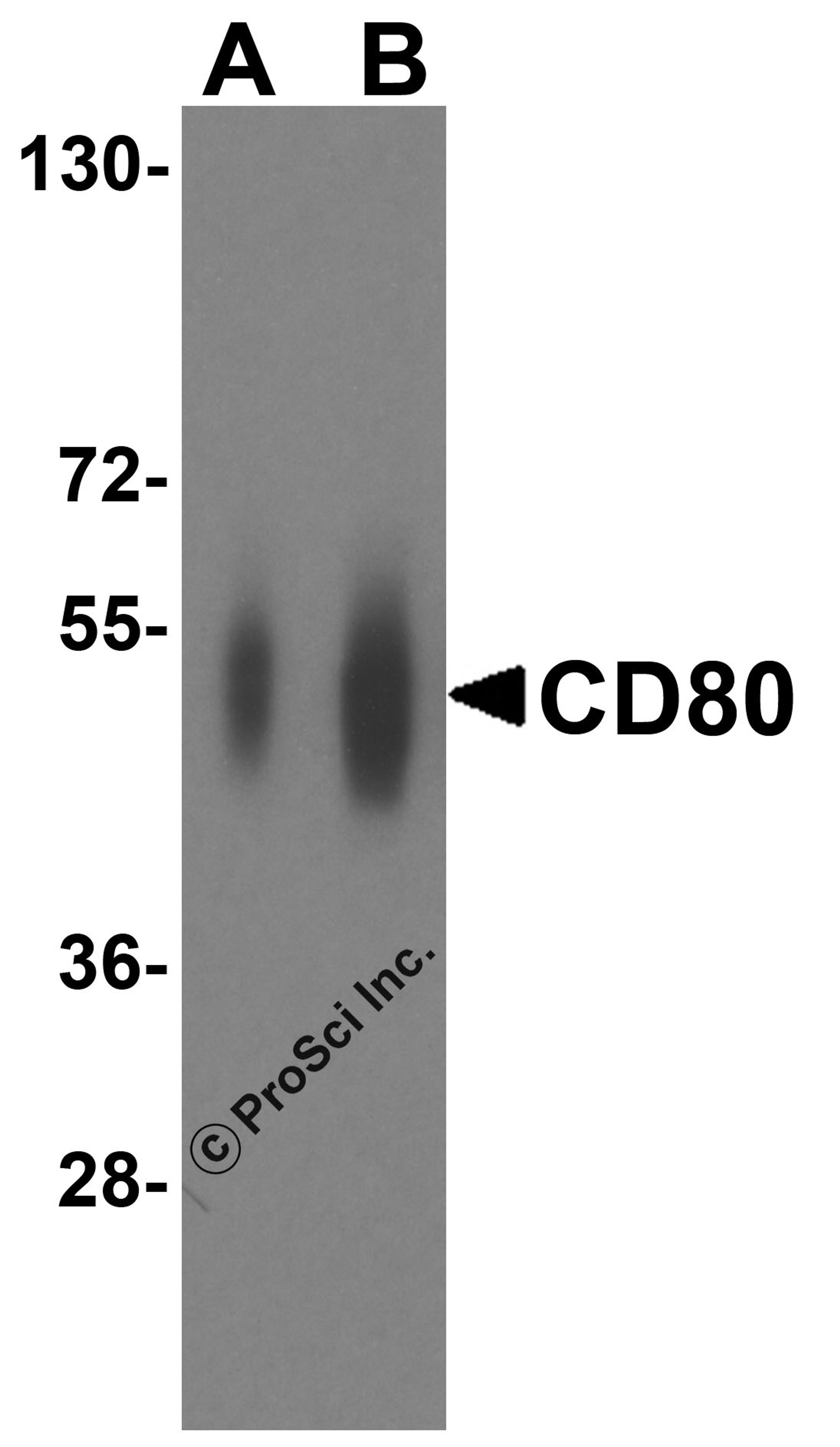 Western blot analysis of CD80 in overexpressing HEK293 cells CD80 antibody at 0.25 and 0.5 μg/ml