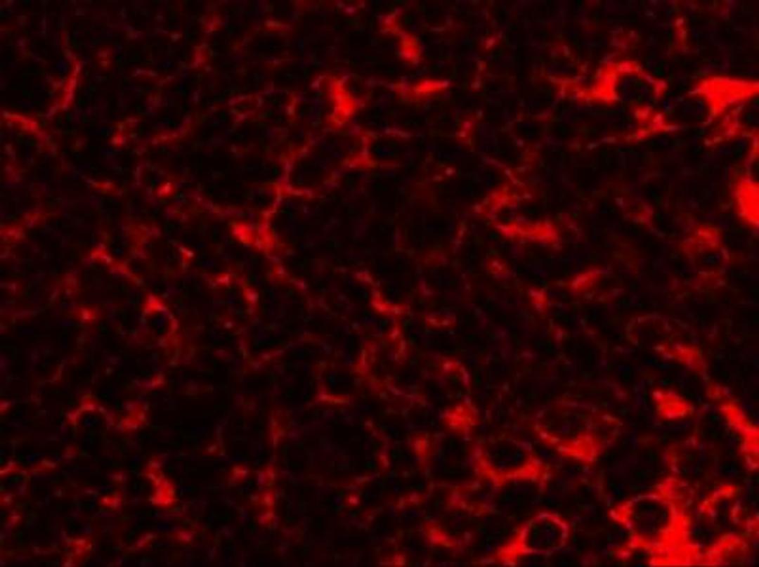 Immunocytochemistry/Immunofluorescence: TMEM38B Antibody [NBP1-77093] - Immunofluorescence of TMEM38B in mouse thymus tissue with TMEM38B antibody at 20 ug/mL.