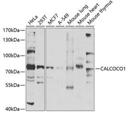 Western blot - CALCOCO1 antibody (A7987)