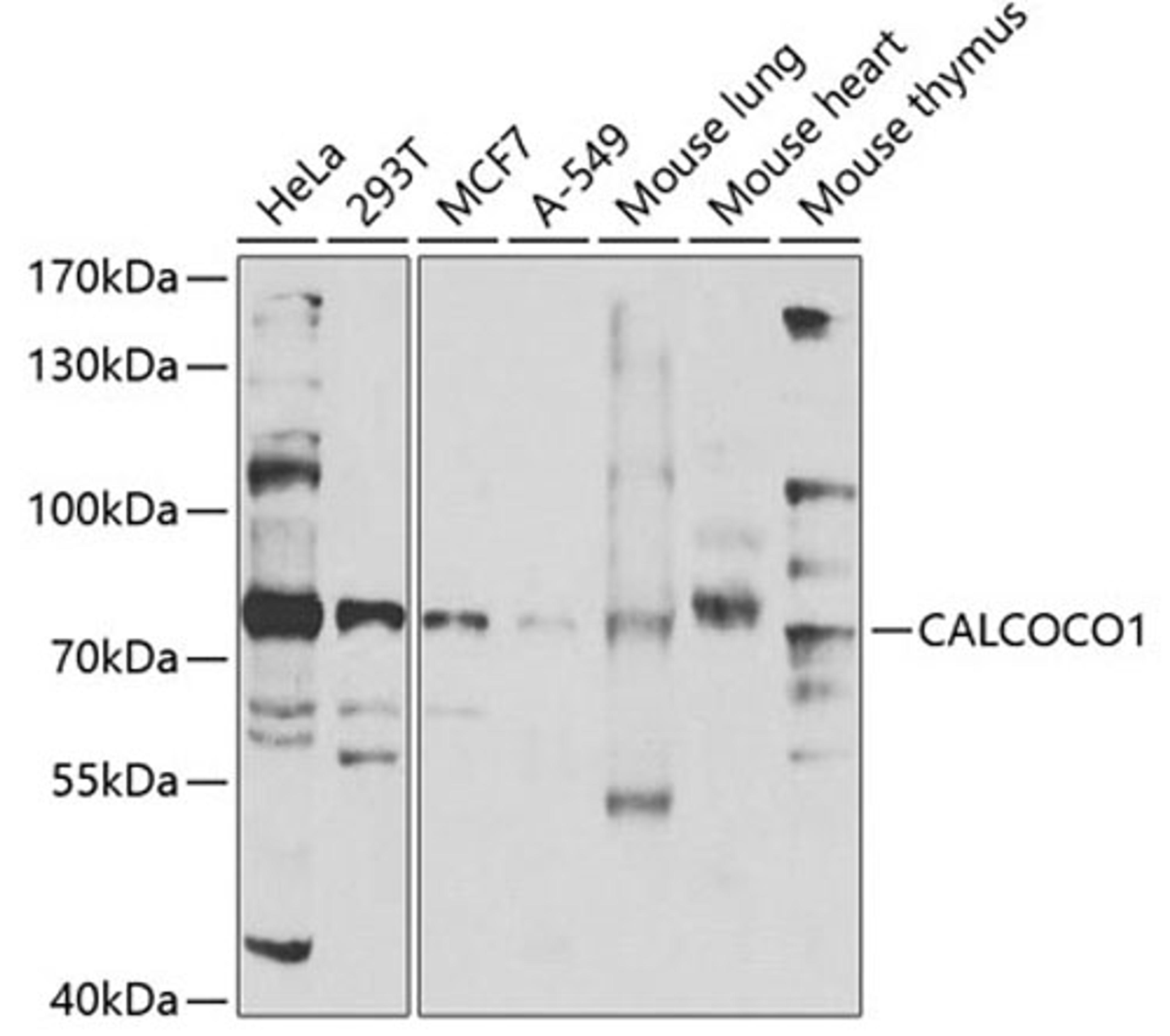 Western blot - CALCOCO1 antibody (A7987)