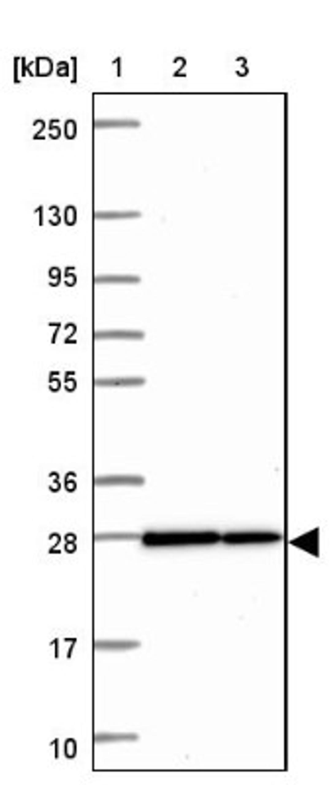 Western Blot: HMGB3/HMG4 Antibody [NBP2-47434] - Lane 1: Marker [kDa] 250, 130, 95, 72, 55, 36, 28, 17, 10.  Lane 2: Human cell line RT-4.  Lane 3: Human cell line U-251MG.