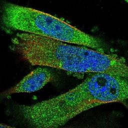 Immunocytochemistry/Immunofluorescence: SMCP Antibody [NBP1-81252] - Staining of human cell line U-251MG shows positivity in cytoplasm.