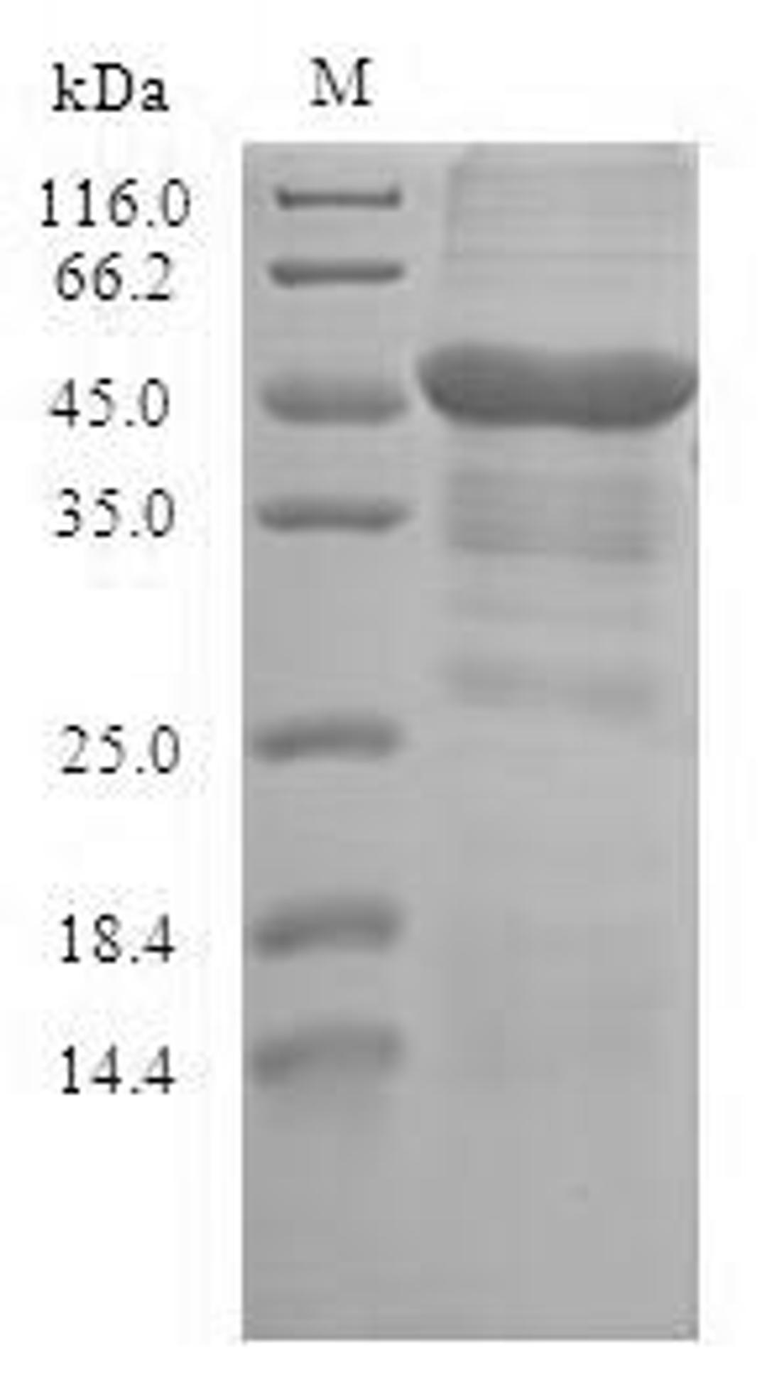 (Tris-Glycine gel) Discontinuous SDS-PAGE (reduced) with 5% enrichment gel and 15% separation gel.