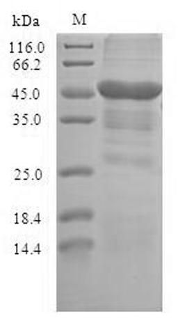 (Tris-Glycine gel) Discontinuous SDS-PAGE (reduced) with 5% enrichment gel and 15% separation gel.