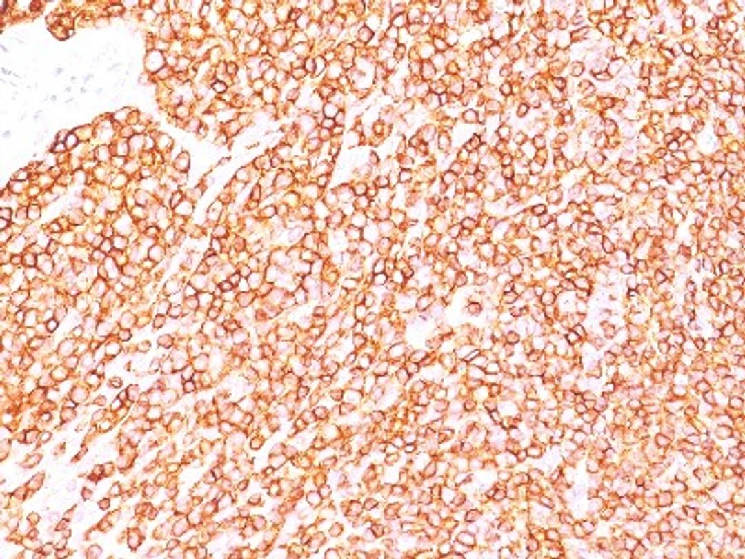 Immunohistochemistry-Paraffin: CD45RB Antibody (BRA-11/BRA-11G) [NBP2-33021] - Formalin-fixed, paraffin-embedded human tonsil stained with CD45RB Ab (BRA-11).