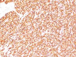 Immunohistochemistry-Paraffin: CD45RB Antibody (BRA-11/BRA-11G) [NBP2-33021] - Formalin-fixed, paraffin-embedded human tonsil stained with CD45RB Ab (BRA-11).