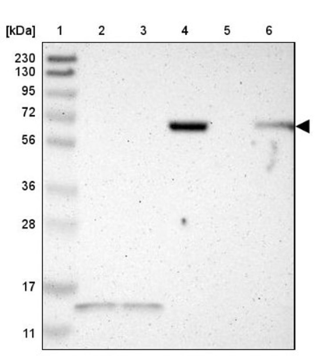 Western Blot: JPH1 Antibody [NBP1-83075] - Lane 1: Marker [kDa] 230, 130, 95, 72, 56, 36, 28, 17, 11<br/>Lane 2: Human cell line RT-4<br/>Lane 3: Human cell line U-251MG sp<br/>Lane 4: Human plasma (IgG/HSA depleted)<br/>Lane 5: Human liver tissue<br/>Lane 6: Human tonsil tissue