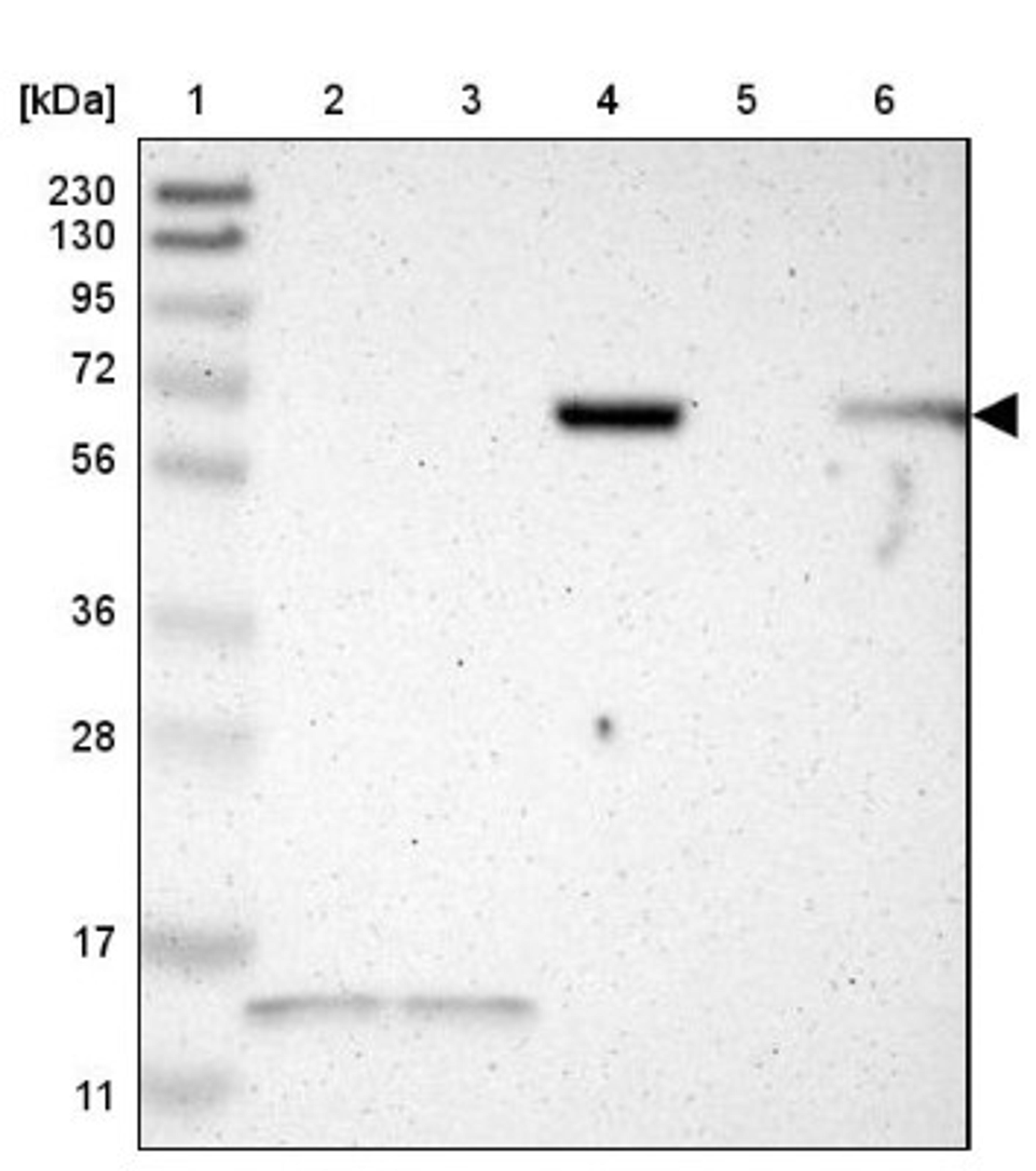 Western Blot: JPH1 Antibody [NBP1-83075] - Lane 1: Marker [kDa] 230, 130, 95, 72, 56, 36, 28, 17, 11<br/>Lane 2: Human cell line RT-4<br/>Lane 3: Human cell line U-251MG sp<br/>Lane 4: Human plasma (IgG/HSA depleted)<br/>Lane 5: Human liver tissue<br/>Lane 6: Human tonsil tissue