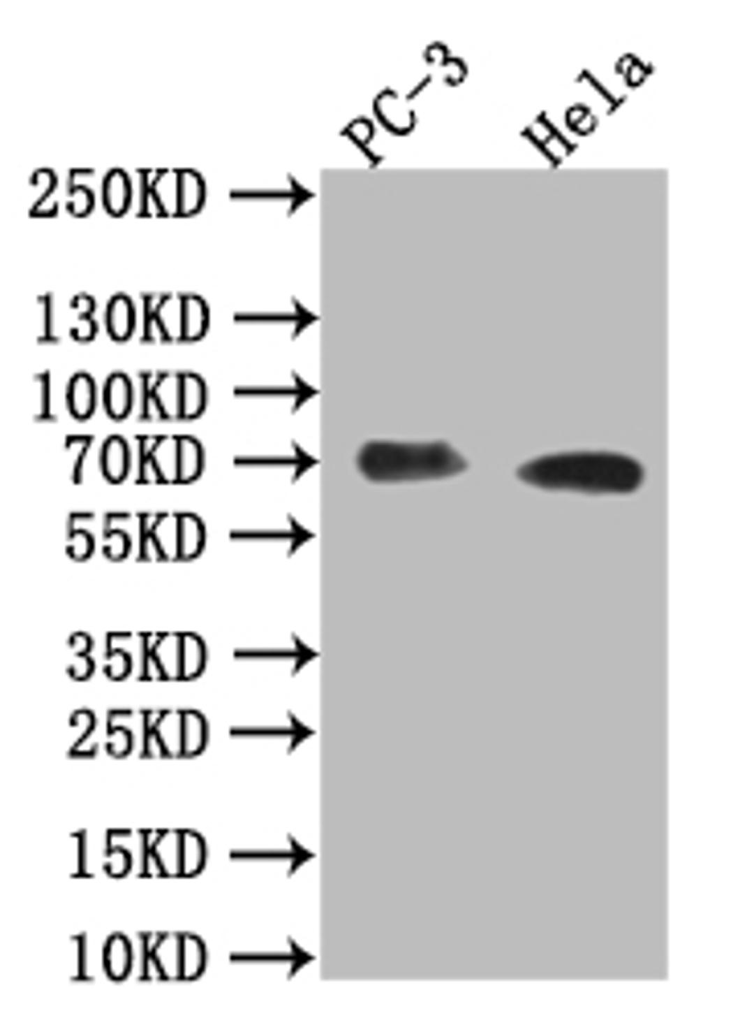 Western Blot. Positive WB detected in: PC-3 whole cell lysate,Hela whole cell lysate. All lanes: Placental alkaline phosphatase (PLAP) antibody at 1:1000. Secondary. Goat polyclonal to rabbit IgG at 1/50000 dilution. Predicted band size: 70 kDa. Observed band size: 70 kDa. 