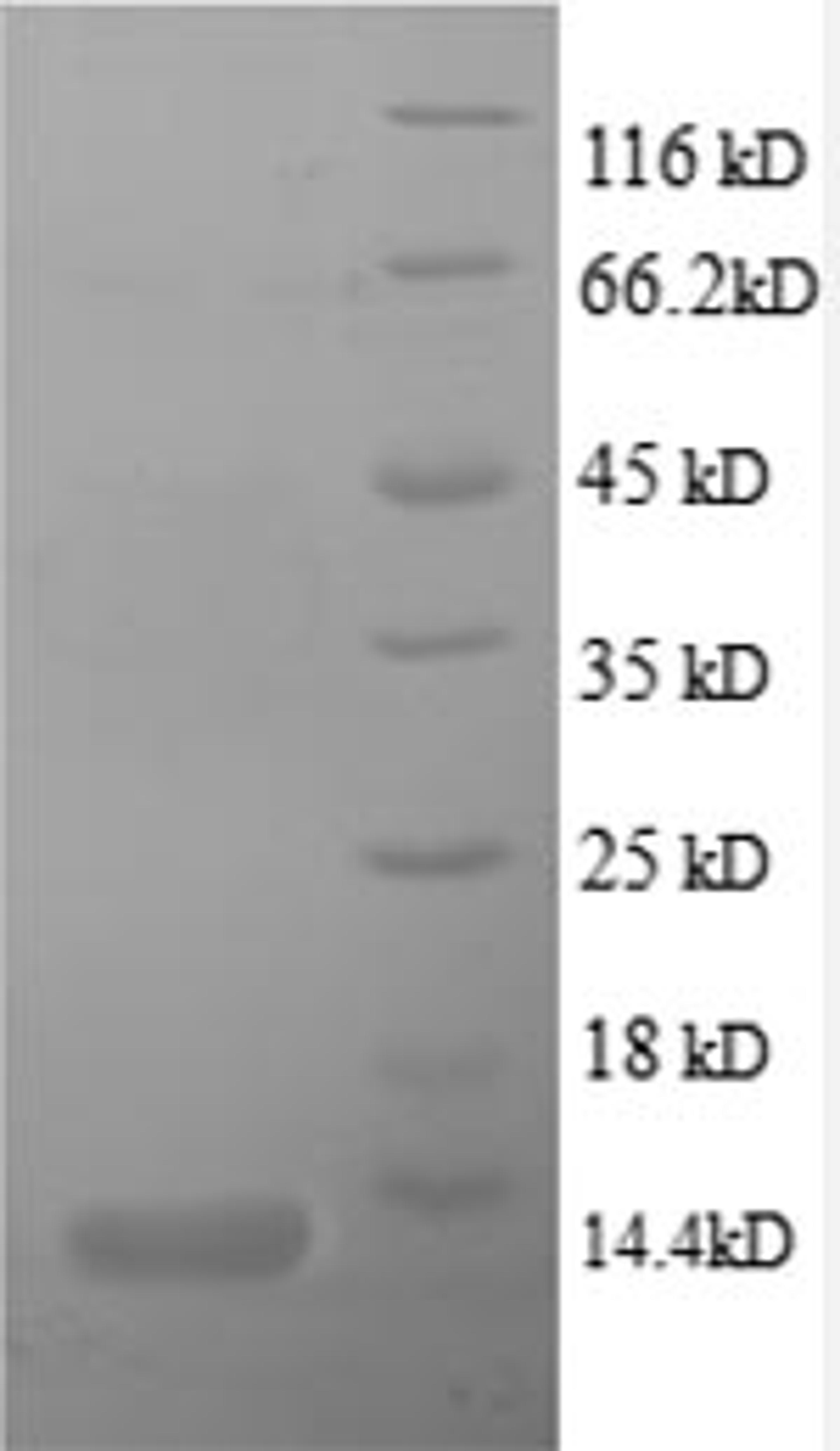 (Tris-Glycine gel) Discontinuous SDS-PAGE (reduced) with 5% enrichment gel and 15% separation gel.