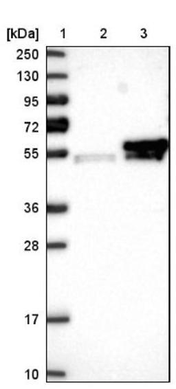 Western Blot: KCMF1 Antibody [NBP1-84283] - Lane 1: Marker [kDa] 250, 130, 95, 72, 55, 36, 28, 17, 10<br/>Lane 2: Negative control (vector only transfected HEK293T lysate)<br/>Lane 3: Over-expression lysate (Co-expressed with a C-terminal myc-DDK tag (~3.1 kDa) in mammalian HEK293T cells, LY412662)