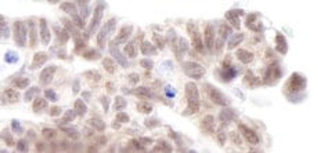 Detection of human AF9 by immunohistochemistry.