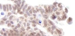 Detection of human AF9 by immunohistochemistry.