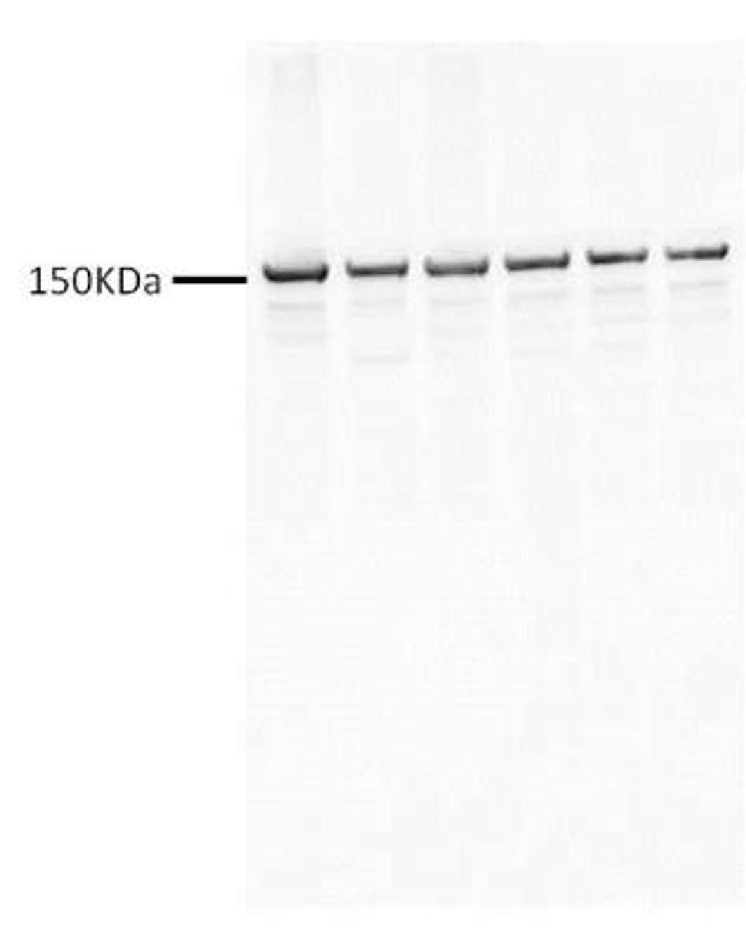 Western Blot: VEGF R2/KDR/Flk-1 Antibody [NB100-627] - Analysis of VEGF R2/KDR/Flk-1 in mouse brain tumor lysates using anti-VEGF R2/KDR/Flk-1 antibody. Image from verified customer review.