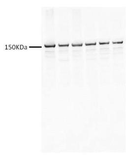 Western Blot: VEGF R2/KDR/Flk-1 Antibody [NB100-627] - Analysis of VEGF R2/KDR/Flk-1 in mouse brain tumor lysates using anti-VEGF R2/KDR/Flk-1 antibody. Image from verified customer review.