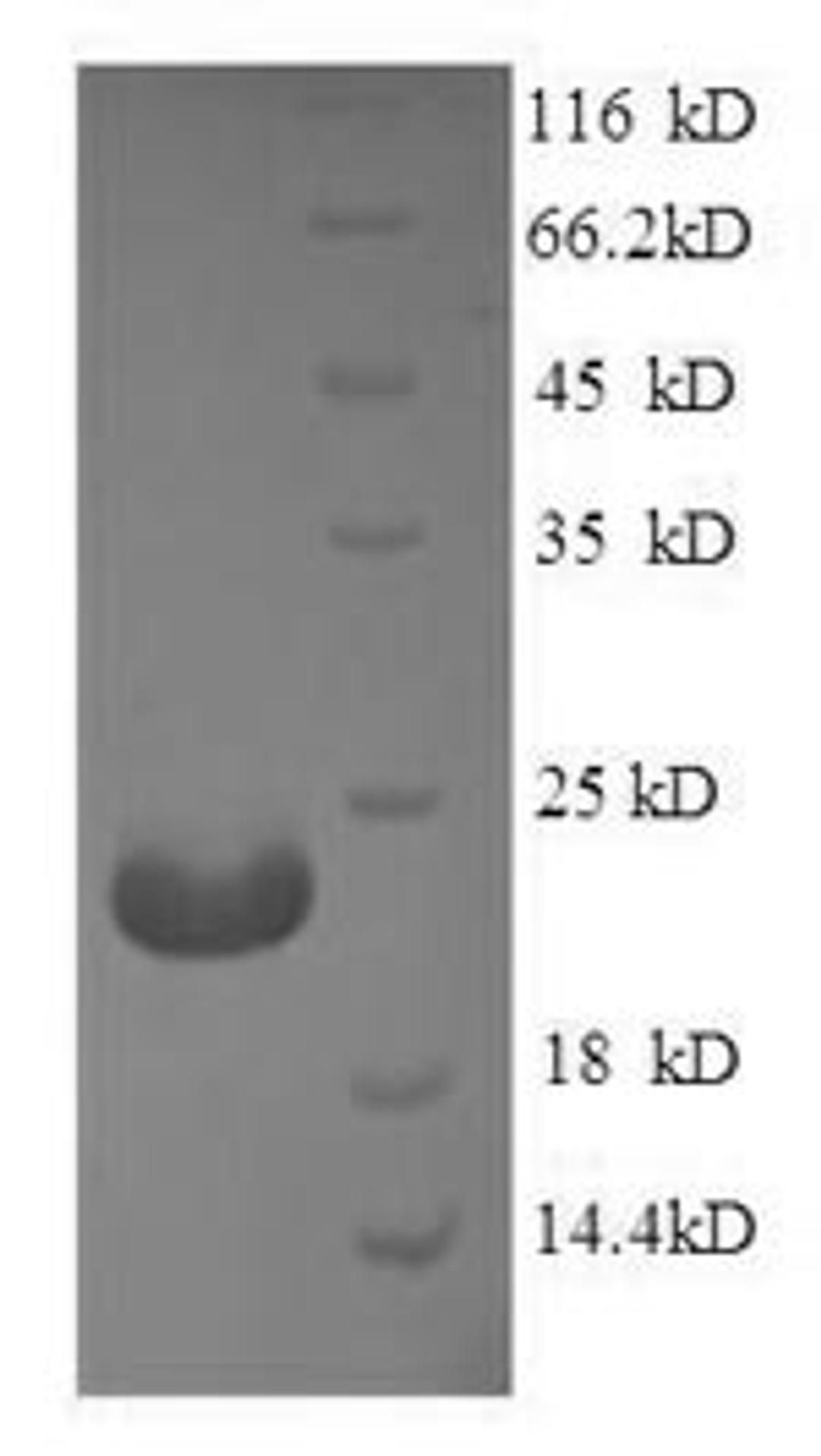 (Tris-Glycine gel) Discontinuous SDS-PAGE (reduced) with 5% enrichment gel and 15% separation gel.