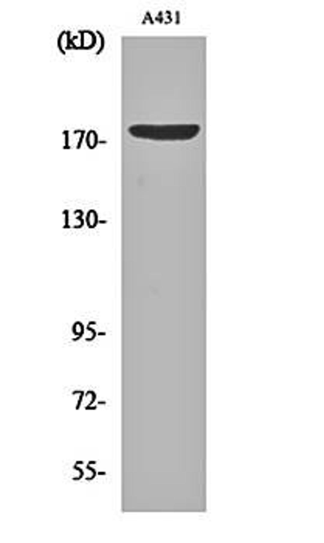 Western blot analysis of A431 cell lysates using EGFR (phospho-Y1197) antibody